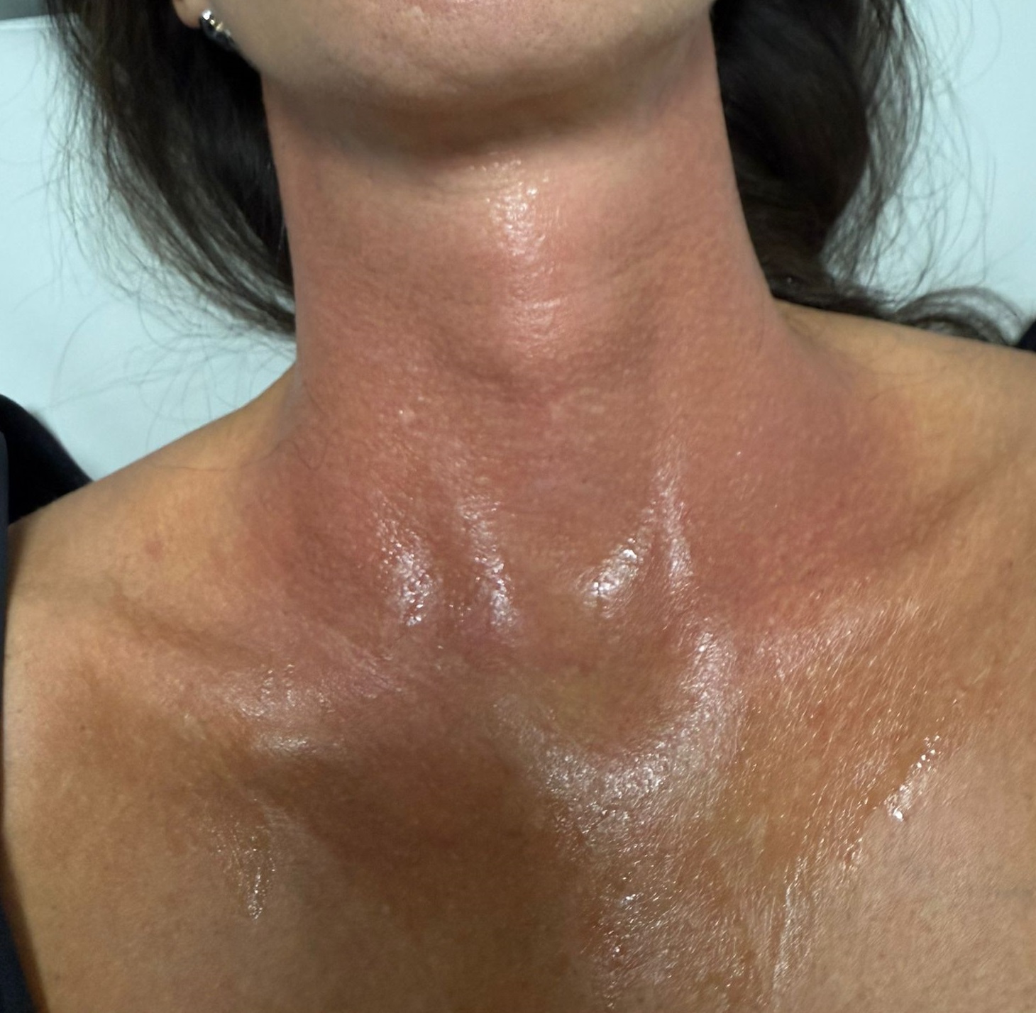 Zabiegi odmładzające Krapkowice